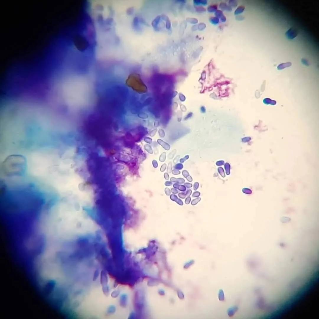 Citología cutánea con presencia de levaduras Malassezia spp. bajo microscopio — tinción Diff-Quick, diagnóstico dermatológico basado en evidencia citológica. Zoovet.