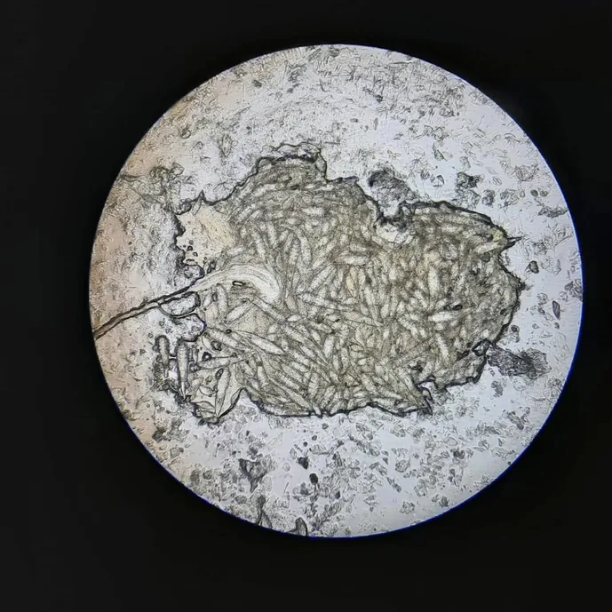 Muestra citológica bajo microscopio óptico en laboratorio de diagnóstico veterinario clínico. Zoovet.